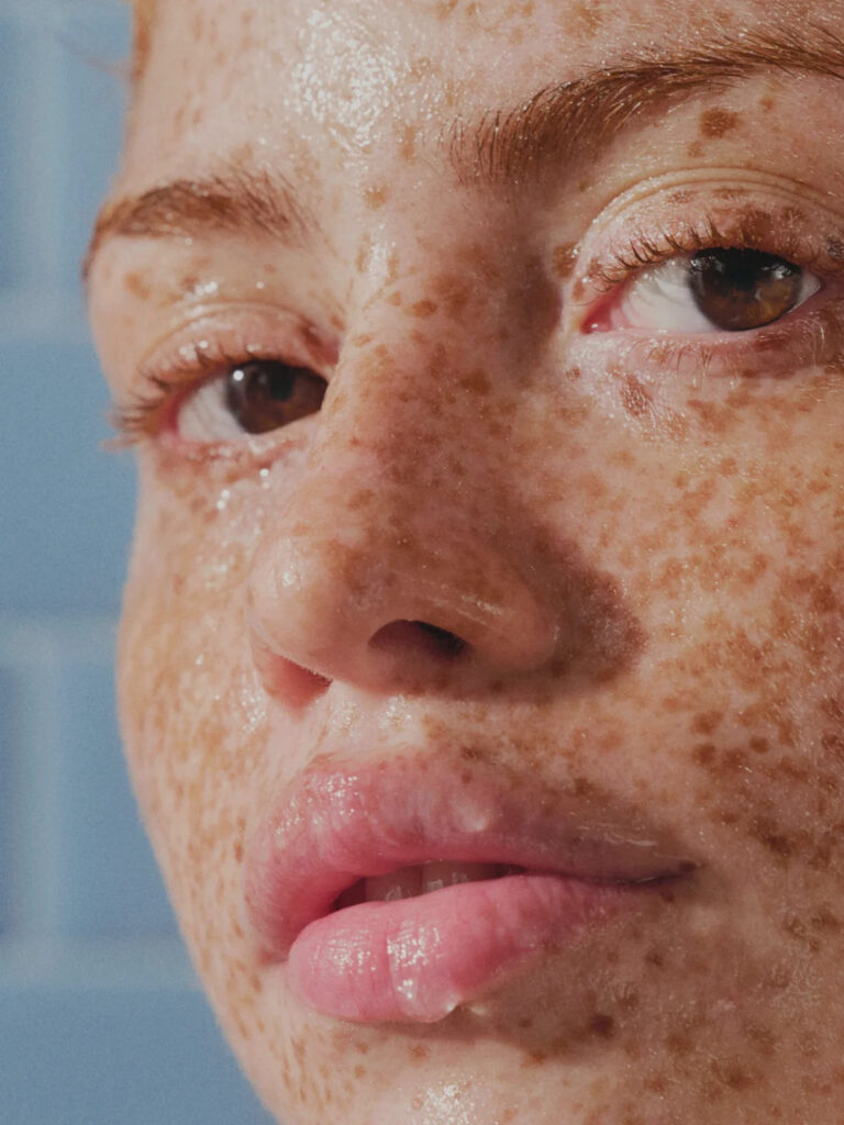 Hers Skin CategoryPage Module2 ProductTiles 1 Acne